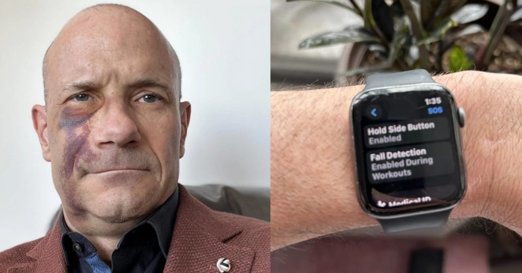 apple-watch-fall-detection-helps-rescue-cyclist-after-crash-during-downpour